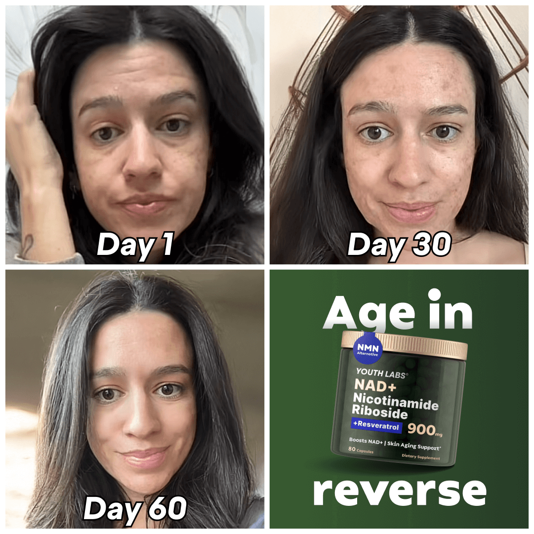 NAD+ Booster Complex