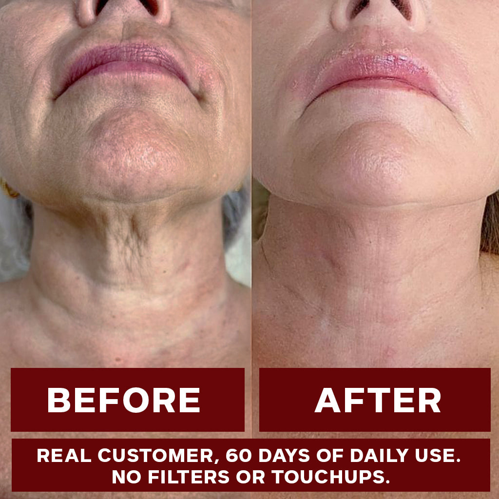 [ONE-TIME OFFER] Buy One, Get TWO FREE